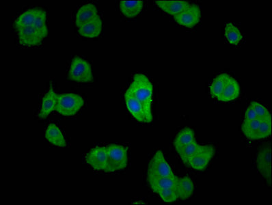 CD2AP Polyclonal Antibody - image 4