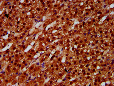 IHC image of CAC15424 diluted at 1:600 and staining in paraffin-embedded human pancreatic tissue performed on a Leica BondTM system. After dewaxing and hydration, antigen retrieval was mediated by high pressure in a citrate buffer (pH 6.0). Section was blocked with 10% normal goat serum 30min at RT. Then primary antibody (1% BSA) was incubated at 4°C overnight. The primary is detected by a biotinylated secondary antibody and visualized using an HRP conjugated SP system.