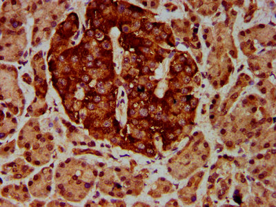 ETV5 Polyclonal Antibody - image 4