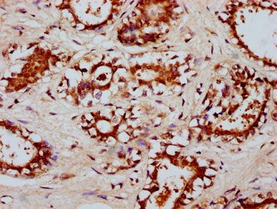 RYK Polyclonal Antibody - image 4