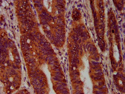 Immunofluorescence staining of Hela cells with CAC15430 at 1:133, counter-stained with DAPI. The cells were fixed in 4% formaldehyde, permeabilized using 0.2% Triton X-100 and blocked in 10% normal Goat Serum. The cells were then incubated with the antibody overnight at 4°C. The secondary antibody was Alexa Fluor 488-congugated AffiniPure Goat Anti-Rabbit IgG(H+L).