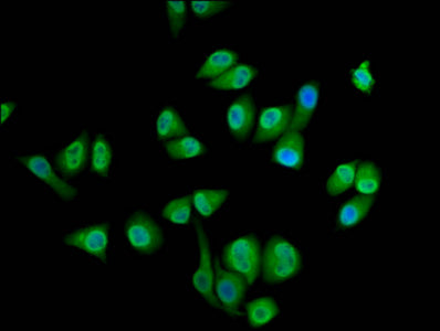SEC14L2 Polyclonal Antibody - image 5