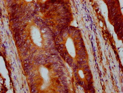 VTN Polyclonal Antibody - image 3