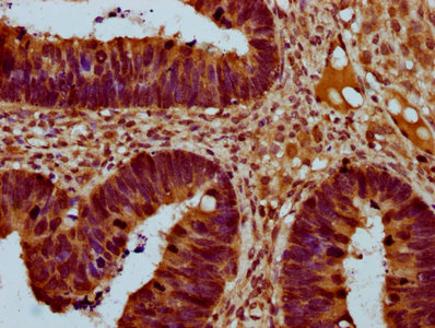 THNSL2 Polyclonal Antibody - image 3