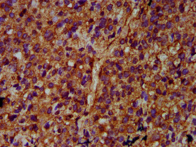 ULK2 Polyclonal Antibody - image 4