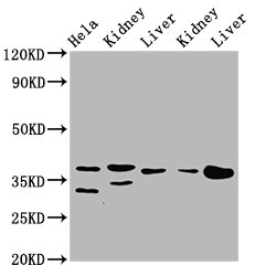 IHC image of CAC15445 diluted at 1:200 and staining in paraffin-embedded human prostate tissue performed on a Leica BondTM system. After dewaxing and hydration, antigen retrieval was mediated by high pressure in a citrate buffer (pH 6.0). Section was blocked with 10% normal goat serum 30min at RT. Then primary antibody (1% BSA) was incubated at 4°C overnight. The primary is detected by a biotinylated secondary antibody and visualized using an HRP conjugated SP system.