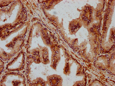 PPA2 Polyclonal Antibody - image 3