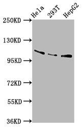 IHC image of CAC15448 diluted at 1:400 and staining in paraffin-embedded human liver tissue performed on a Leica BondTM system. After dewaxing and hydration, antigen retrieval was mediated by high pressure in a citrate buffer (pH 6.0). Section was blocked with 10% normal goat serum 30min at RT. Then primary antibody (1% BSA) was incubated at 4°C overnight. The primary is detected by a biotinylated secondary antibody and visualized using an HRP conjugated SP system.