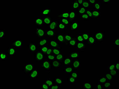 Chromatin Immunoprecipitation Hela (4*10 6 , treated with 30mM sodium butyrate for 4h) were treated with Benzanase, sonicated, and immunoprecipitated with 5ug anti-HIST1H4A (CAC15465) or a control normal rabbit IgG. The resulting ChIP DNA was quantified using real-time PCR with primers against the β-Globin promoter.