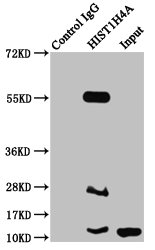 2-hydroxyisobutyryl-HIST1H4A (K16) Polyclonal Antibody - image 5