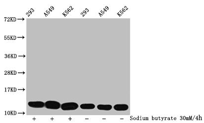 2-hydroxyisobutyryl-HIST1H4A (K77) Polyclonal Antibody - image 2