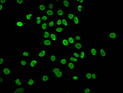 Immunocytochemistry analysis of CAC15469 diluted at 1:80 and staining in Hela cells (treated with 30mM sodium butyrate for 4h) performed on a Leica BondTM system. The cells were fixed in 4% formaldehyde, permeabilized using 0.2% Triton X-100 and blocked with 10% normal goat serum 30min at RT. Then primary antibody (1% BSA) was incubated at 4°C overnight. The primary is detected by a biotinylated secondary antibody and visualized using an HRP conjugated SP system.