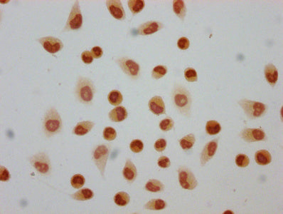 2-hydroxyisobutyryl-HIST1H4A (K5) Polyclonal Antibody - image 4