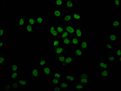Immunocytochemistry analysis of CAC15476 diluted at 1:15 and staining in Hela cells (treated with 30mM sodium butyrate for 4h) performed on a Leica BondTM system. The cells were fixed in 4% formaldehyde, permeabilized using 0.2% Triton X-100 and blocked with 10% normal goat serum 30min at RT. Then primary antibody (1% BSA) was incubated at 4°C overnight. The primary is detected by a biotinylated secondary antibody and visualized using an HRP conjugated SP system.