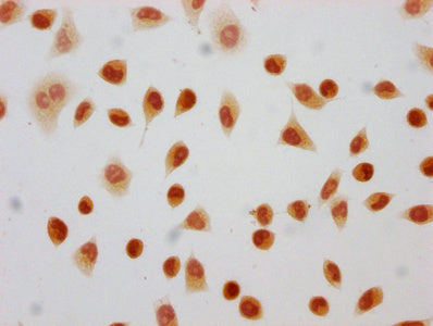 2-hydroxyisobutyryl-HIST1H4A (K8) Polyclonal Antibody - image 4