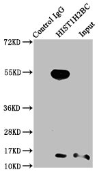 Chromatin Immunoprecipitation Hela (4*10 6 , treated with 30mM sodium crotonylate for 4h) were treated with Micrococcal Nuclease, sonicated, and immunoprecipitated with 5ug anti-HIST1H2BC (CAC15482) or a control normal rabbit IgG. The resulting ChIP DNA was quantified using real-time PCR with primers against the β-Globin promoter.