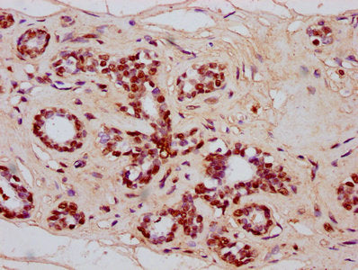 IHC image of CAC15489 diluted at 1:20 and staining in paraffin-embedded human adrenal gland tissue performed on a Leica BondTM system. After dewaxing and hydration, antigen retrieval was mediated by high pressure in a citrate buffer (pH 6.0). Section was blocked with 10% normal goat serum 30min at RT. Then primary antibody (1% BSA) was incubated at 4°C overnight. The primary is detected by a biotinylated secondary antibody and visualized using an HRP conjugated SP system.