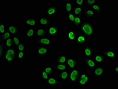 2-hydroxyisobutyryl-HIST1H2BC (K108) Polyclonal Antibody - image 3