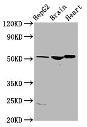 IHC image of CAC15513 diluted at 1:500 and staining in paraffin-embedded human liver cancer performed on a Leica BondTM system. After dewaxing and hydration, antigen retrieval was mediated by high pressure in a citrate buffer (pH 6.0). Section was blocked with 10% normal goat serum 30min at RT. Then primary antibody (1% BSA) was incubated at 4°C overnight. The primary is detected by a biotinylated secondary antibody and visualized using an HRP conjugated SP system.