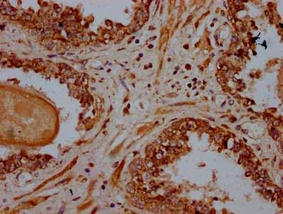 IHC image of CAC15530 diluted at 1:600 and staining in paraffin-embedded human heart tissue performed on a Leica BondTM system. After dewaxing and hydration, antigen retrieval was mediated by high pressure in a citrate buffer (pH 6.0). Section was blocked with 10% normal goat serum 30min at RT. Then primary antibody (1% BSA) was incubated at 4°C overnight. The primary is detected by a biotinylated secondary antibody and visualized using an HRP conjugated SP system.