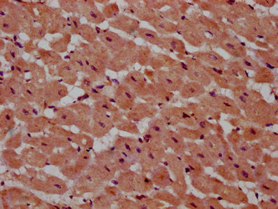 PSME4 Polyclonal Antibody - image 4