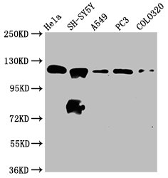 IHC image of CAC15535 diluted at 1:800 and staining in paraffin-embedded human prostate tissue performed on a Leica BondTM system. After dewaxing and hydration, antigen retrieval was mediated by high pressure in a citrate buffer (pH 6.0). Section was blocked with 10% normal goat serum 30min at RT. Then primary antibody (1% BSA) was incubated at 4°C overnight. The primary is detected by a biotinylated secondary antibody and visualized using an HRP conjugated SP system.