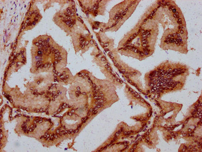 IHC image of CAC15535 diluted at 1:800 and staining in paraffin-embedded human adrenal gland tissue performed on a Leica BondTM system. After dewaxing and hydration, antigen retrieval was mediated by high pressure in a citrate buffer (pH 6.0). Section was blocked with 10% normal goat serum 30min at RT. Then primary antibody (1% BSA) was incubated at 4°C overnight. The primary is detected by a biotinylated secondary antibody and visualized using an HRP conjugated SP system.