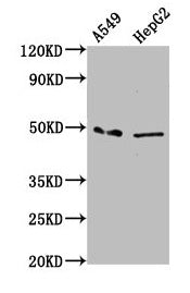 Immunofluorescence staining of Hela cells with CAC15539 at 1:166, counter-stained with DAPI. The cells were fixed in 4% formaldehyde, permeabilized using 0.2% Triton X-100 and blocked in 10% normal Goat Serum. The cells were then incubated with the antibody overnight at 4°C. The secondary antibody was Alexa Fluor 488-congugated AffiniPure Goat Anti-Rabbit IgG(H+L).