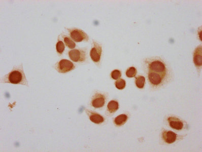Chromatin Immunoprecipitation Hela (4*10 6 ) were treated with Micrococcal Nuclease, sonicated, and immunoprecipitated with 5ug anti-HIST1H2BC (CAC15545) or a control normal rabbit IgG. The resulting ChIP DNA was quantified using real-time PCR with primers against the β-Globin promoter.