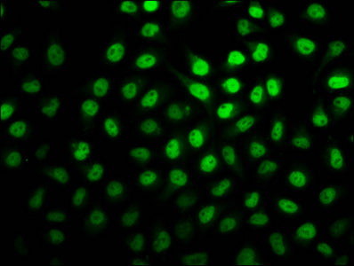 2-hydroxyisobutyryl-HIST1H2BC (K20) Polyclonal Antibody - image 3