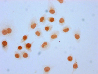 Immunofluorescence staining of Hela cells (treated with 30mM sodium butyrate for 4h) with CAC15566 at 1:20, counter-stained with DAPI. The cells were fixed in 4% formaldehyde, permeabilized using 0.2% Triton X-100 and blocked in 10% normal Goat Serum. The cells were then incubated with the antibody overnight at 4°C. The secondary antibody was Alexa Fluor 488-congugated AffiniPure Goat Anti-Rabbit IgG(H+L).