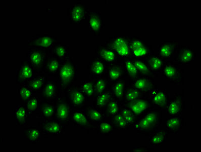 2-hydroxyisobutyryl-HIST1H3A (K4) Polyclonal Antibody - image 4