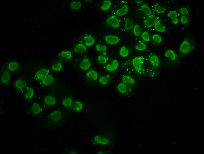 Chromatin Immunoprecipitation Hela (10 6 , treated with 30mM sodium butyrate for 4h) were treated with Micrococcal Nuclease, sonicated, and immunoprecipitated with 5ug anti-HIST1H2BC (CAC15568) or a control normal rabbit IgG. The resulting ChIP DNA was quantified using real-time PCR with primers against the β-Globin promoter.