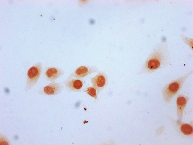 Immunofluorescence staining of Hela cells (treated with 30mM sodium butyrate for 4h) with CAC15575 at 1:7.5, counter-stained with DAPI. The cells were fixed in 4% formaldehyde, permeabilized using 0.2% Triton X-100 and blocked in 10% normal Goat Serum. The cells were then incubated with the antibody overnight at 4°C. The secondary antibody was Alexa Fluor 488-congugated AffiniPure Goat Anti-Rabbit IgG(H+L).
