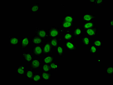 2-hydroxyisobutyryl-HIST1H2BC (K12) Polyclonal Antibody - image 4