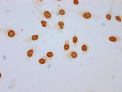 Immunofluorescence staining of Hela cells (treated with 30mM sodium butyrate for 4h) with CAC15581 at 1:50, counter-stained with DAPI. The cells were fixed in 4% formaldehyde, permeabilized using 0.2% Triton X-100 and blocked in 10% normal Goat Serum. The cells were then incubated with the antibody overnight at 4°C. The secondary antibody was Alexa Fluor 488-congugated AffiniPure Goat Anti-Rabbit IgG(H+L).