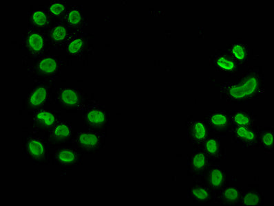 2-hydroxyisobutyryl-HIST1H3A (K18) Polyclonal Antibody - image 4