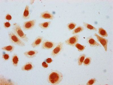 Immunofluorescence staining of Hela cells (treated with 30mM sodium butyrate for 4h) with CAC15593 at 1:12.5, counter-stained with DAPI. The cells were fixed in 4% formaldehyde, permeabilized using 0.2% Triton X-100 and blocked in 10% normal Goat Serum. The cells were then incubated with the antibody overnight at 4°C. The secondary antibody was Alexa Fluor 488-congugated AffiniPure Goat Anti-Rabbit IgG(H+L).