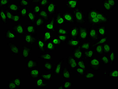 2-hydroxyisobutyryl-HIST1H2BC (K24) Polyclonal Antibody - image 4