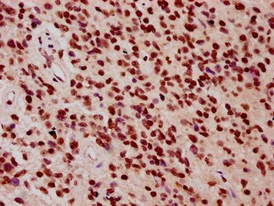 Immunofluorescence staining of MCF-7 cells with CAC15594 at 1:1, counter-stained with DAPI. The cells were fixed in 4% formaldehyde, permeabilized using 0.2% Triton X-100 and blocked in 10% normal Goat Serum. The cells were then incubated with the antibody overnight at 4°C. The secondary antibody was Alexa Fluor 488-congugated AffiniPure Goat Anti-Rabbit IgG(H+L).