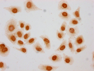 Immunofluorescence staining of Hela cells (treated with 30mM sodium butyrate for 4h) with CAC15599 at 1:5, counter-stained with DAPI. The cells were fixed in 4% formaldehyde, permeabilized using 0.2% Triton X-100 and blocked in 10% normal Goat Serum. The cells were then incubated with the antibody overnight at 4°C. The secondary antibody was Alexa Fluor 488-congugated AffiniPure Goat Anti-Rabbit IgG(H+L).