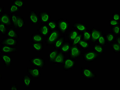 2-hydroxyisobutyryl-HIST1H3A (K27) Polyclonal Antibody - image 4