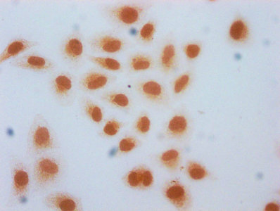 2-hydroxyisobutyryl-HIST1H2AG (K74) Polyclonal Antibody - image 3