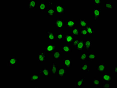 2-hydroxyisobutyryl-HIST1H1C (K22) Polyclonal Antibody - image 3
