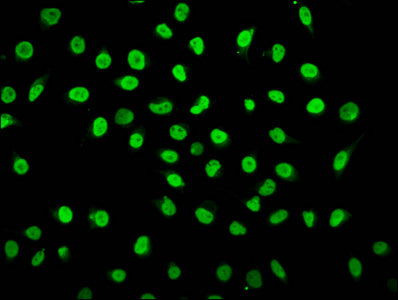 2-hydroxyisobutyryl-HIST1H1C (K25) Polyclonal Antibody - image 3