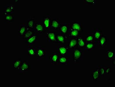 2-hydroxyisobutyryl-HIST1H1C (K26) Polyclonal Antibody - image 3