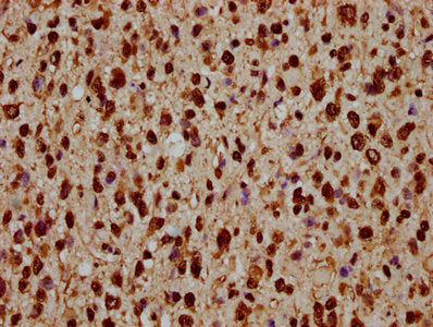 Chromatin Immunoprecipitation Hela (4*10 6 ) were treated with Micrococcal Nuclease, sonicated, and immunoprecipitated with 5ug anti-HIST1H1C (CAC15639) or a control normal rabbit IgG. The resulting ChIP DNA was quantified using real-time PCR with primers against the β-Globin promoter.