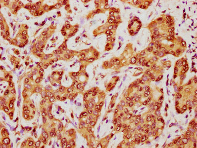 Immunofluorescence staining of Hela cells with CAC15650 at 1:133, counter-stained with DAPI. The cells were fixed in 4% formaldehyde, permeabilized using 0.2% Triton X-100 and blocked in 10% normal Goat Serum. The cells were then incubated with the antibody overnight at 4°C. The secondary antibody was Alexa Fluor 488-congugated AffiniPure Goat Anti-Rabbit IgG(H+L).