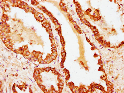 Krt18 Polyclonal Antibody - image 4