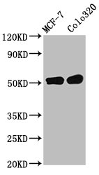 IHC image of CAC15667 diluted at 1:400 and staining in paraffin-embedded human brain tissue performed on a Leica BondTM system. After dewaxing and hydration, antigen retrieval was mediated by high pressure in a citrate buffer (pH 6.0). Section was blocked with 10% normal goat serum 30min at RT. Then primary antibody (1% BSA) was incubated at 4°C overnight. The primary is detected by a biotinylated secondary antibody and visualized using an HRP conjugated SP system.